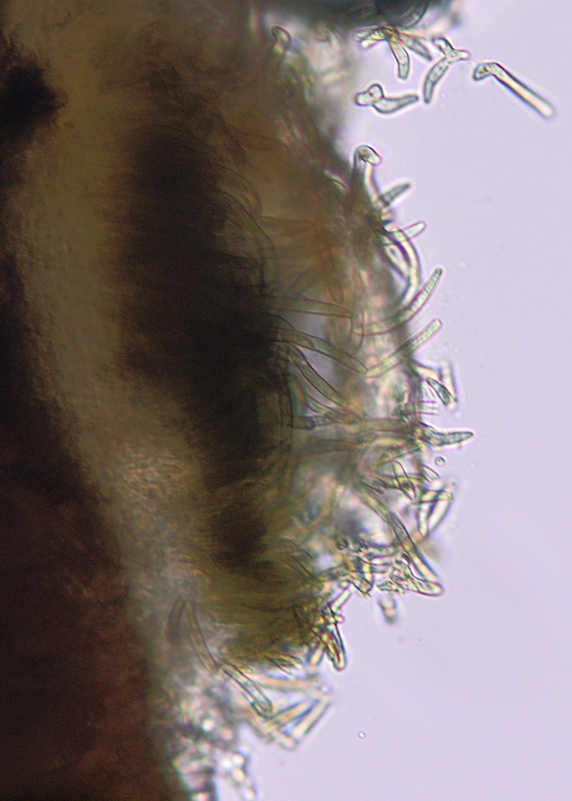 BSNB whitepine acervulus and conidia.jpg